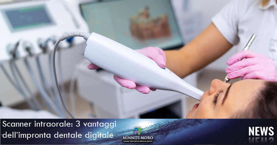 scanner intraorale - impronta dentale digitale