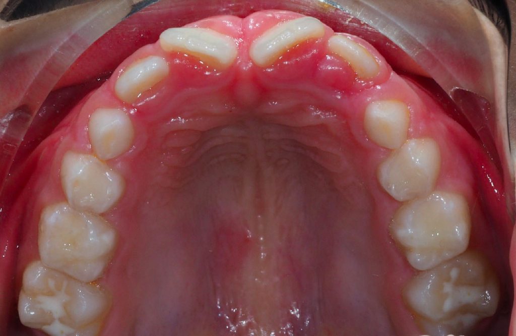 Studio Dentistico Specialistico Minniti Moro | Ortodonzia adulti