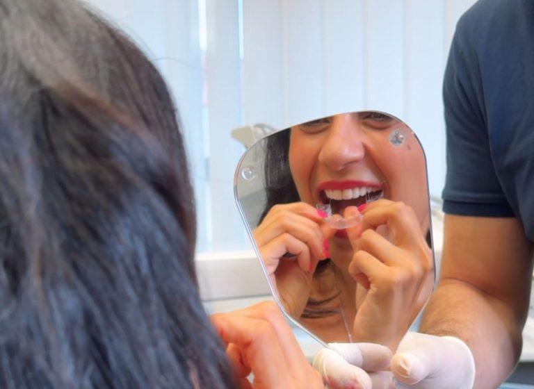 Dentista a Sassari - allineatori trasparenti