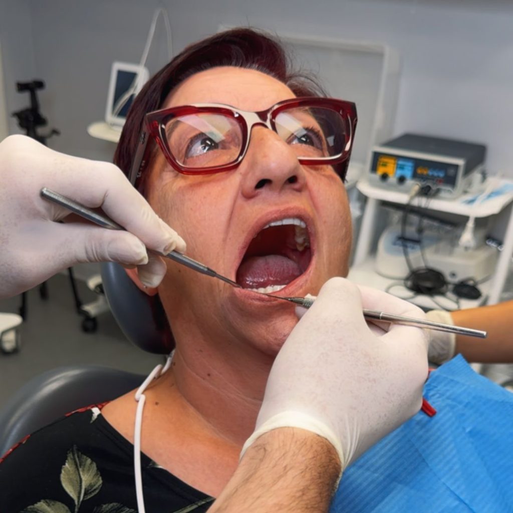 Endodonzia 1 Devitalizzazione dente a Sassari