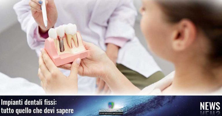 Blog 7 Cosa devi sapere sugli impianti dentali fissi.