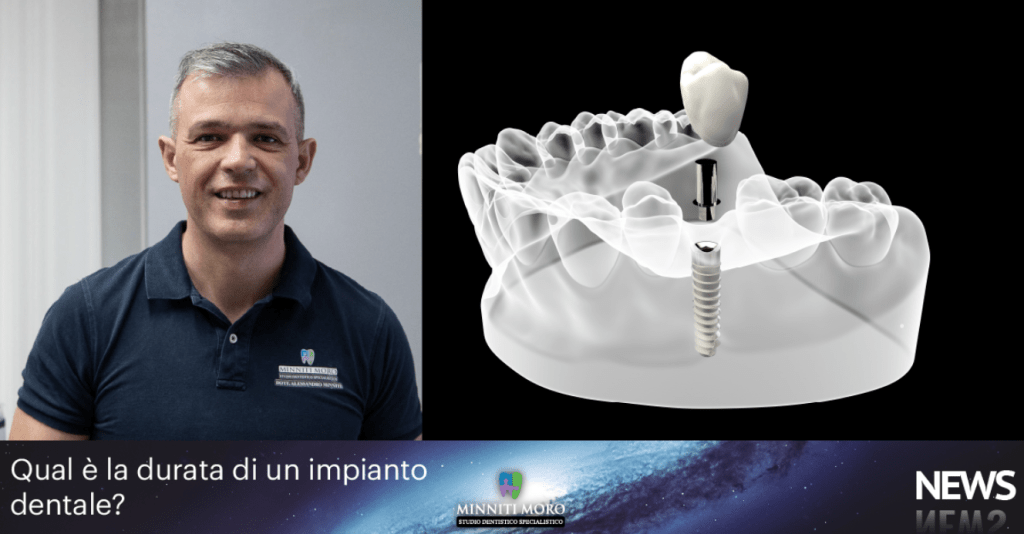 durata di un impianto dentale