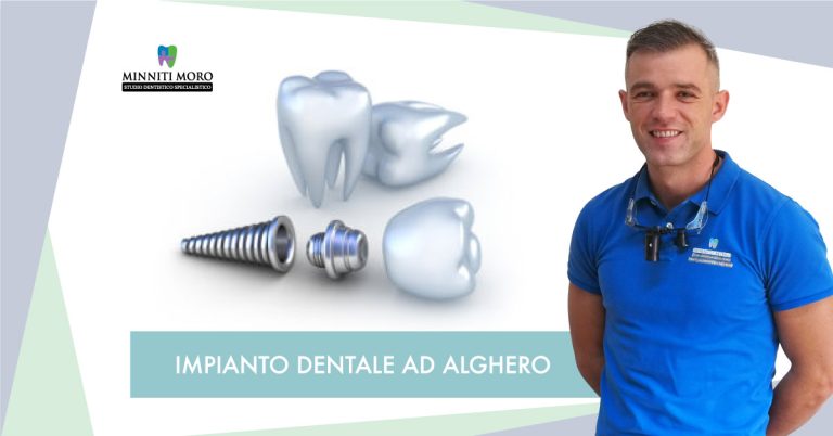 Blog 1 Impianto dentale ad Alghero - Minniti Moro