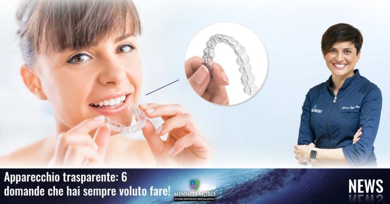Blog 13 6 domande sull'apparecchio trasparente