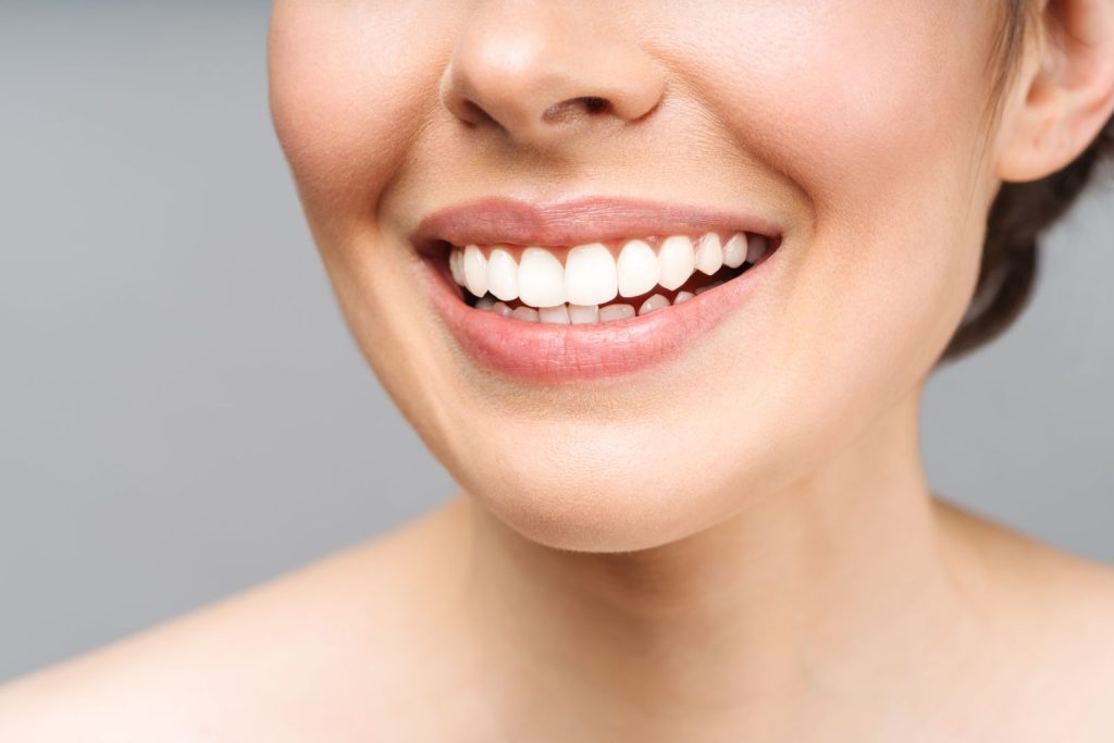 Sorriso perfetto: faccette dentali e tecnica iniettiva 1 Sorriso perfetto
