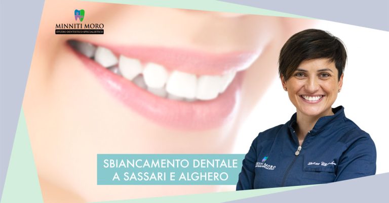 Blog 2 Sbiancamento dentale a Sassari e Alghero